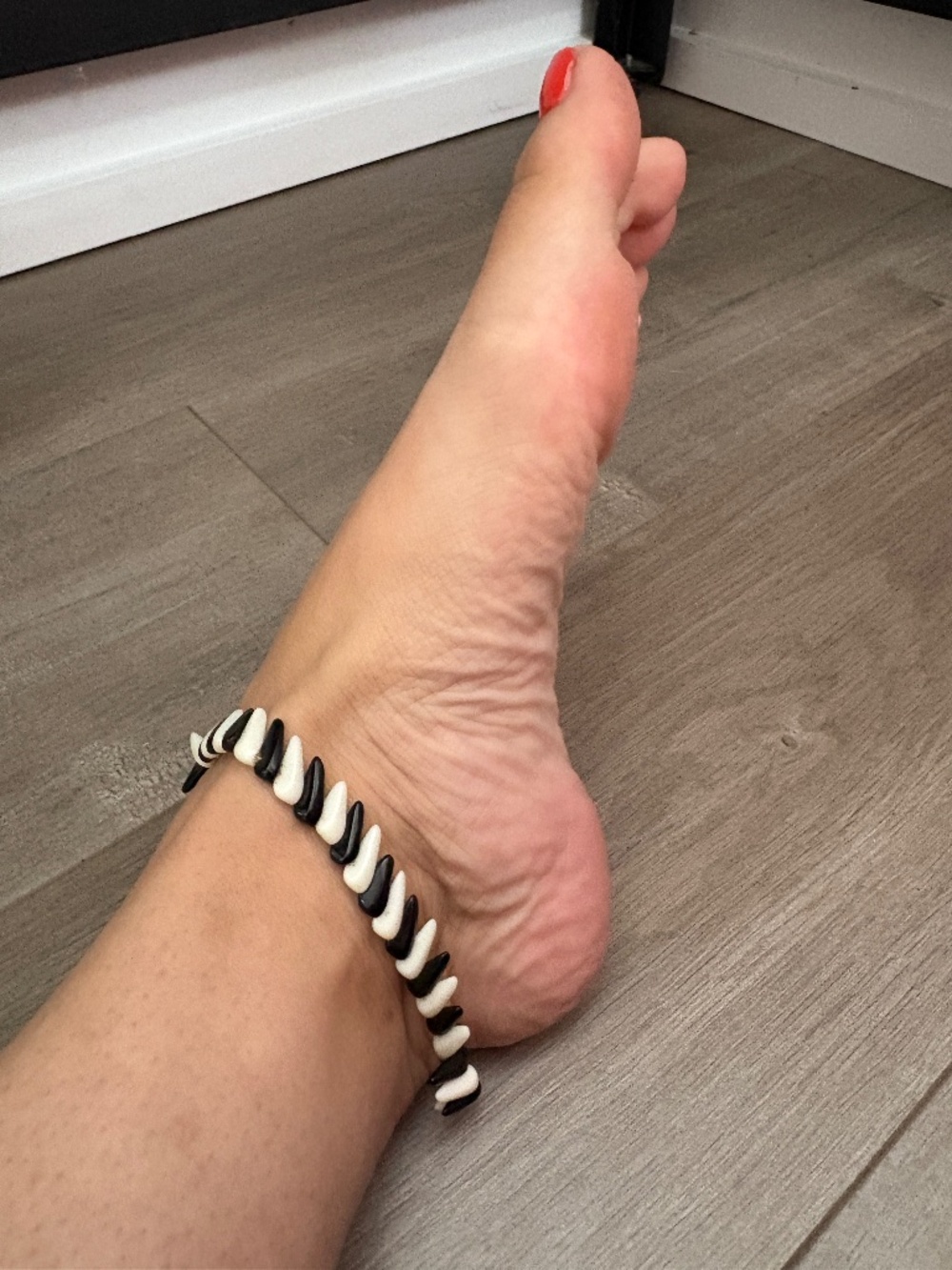 Black & White Polished Tooth-Bead Anklet with Screw Clasp